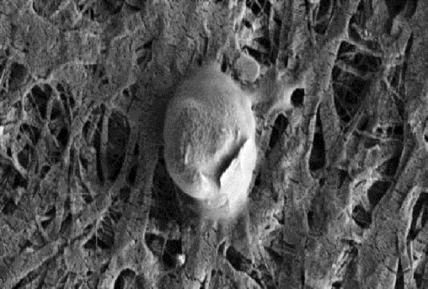 Bactérie observée dans le lac Whillans (en Antarctique occidentale, sous 700 mètres d’épaisseur de glace). On ne sait pas de quel type serait l’être vivant martien et quelle forme il pourrait revêtir mais il pourrait ressembler à ce qu’on voit ici. Ce serait probablement un être de type procaryote (quasi certainement phylogénétiquement différent des procaryotes terrestres) et, selon nos critères, de « style de vie » extrémophile chemo-autotrophe (qui puise son énergie et ses matières constitutives dans les éléments inorganiques qui l’entourent). Il devrait être très petit s’il vit dans les pores du sous-sol et de toute manière, pour être efficace. On estime qu’un être vivant ne peut avoir une taille inférieure à 100 nanomètres pour comprendre les constituants minimum nécessaires à la vie (la taille moyenne d’une bactérie est de l’ordre du micron).